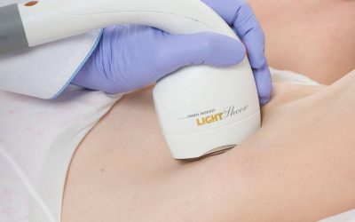Láser de diodos LightSheer XC