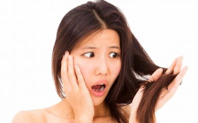 Problemas del Cabello