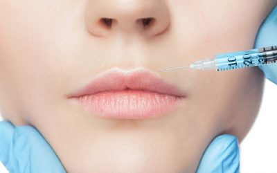 Radiasse inyectable sintetico facial