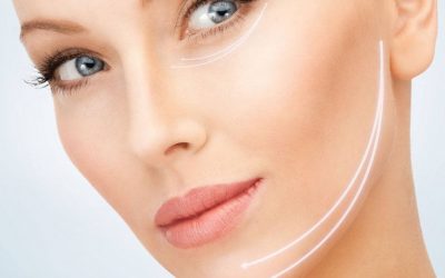 Hilos tensores para el envejecimiento facial