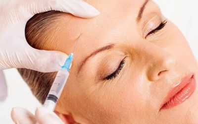 Relleno facial con Sculptra