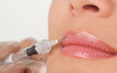 Tratamiento estético para labios