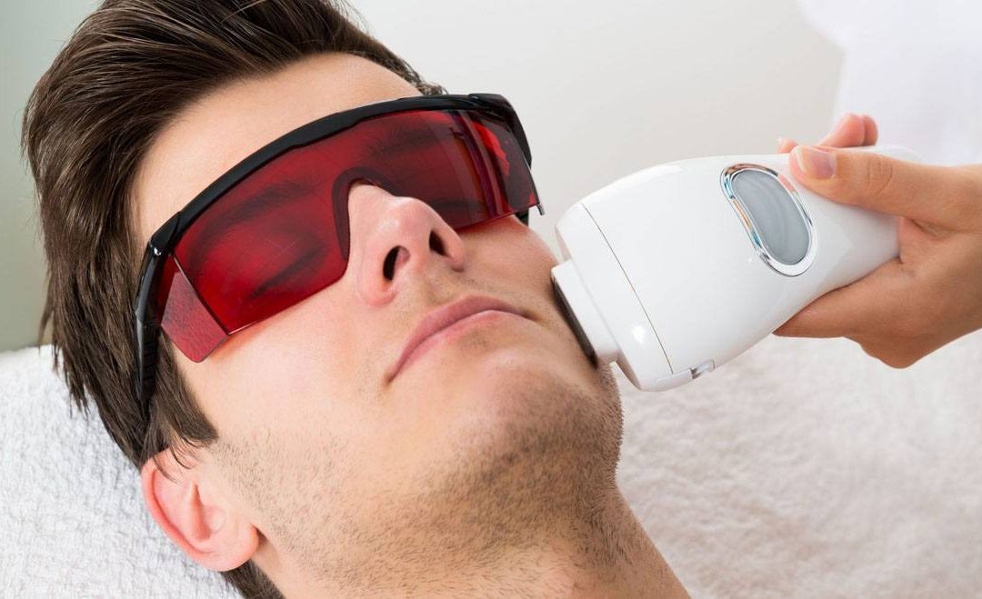 Depilación Láser Masculina