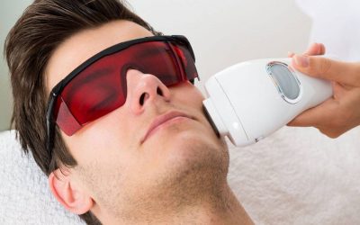 Depilación Láser Masculina